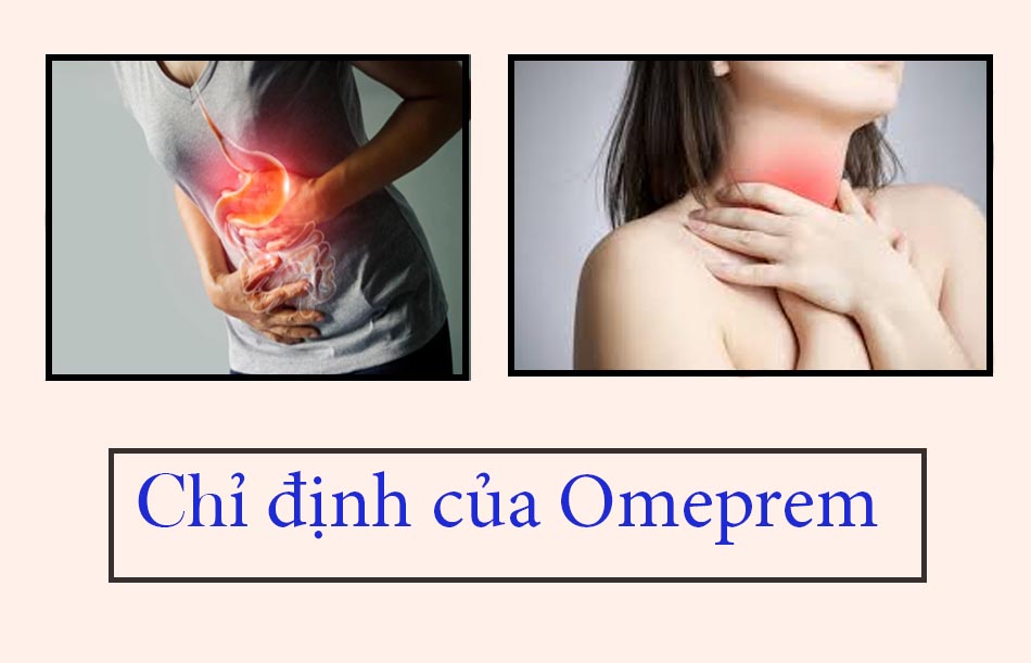 Chỉ định của thuốc Omeprem