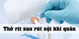 Thở rít sau rút nội khí quản