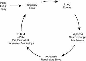 Hình 2. Biểu hiện của vòng luẩn quẩn xảy ra ở bệnh nhân suy hô hấp cấp. Palv = áp lực phế nang; Pes = áp lực thực quản; P-SILI = chấn thương phổi do bệnh nhân tự gây ra.