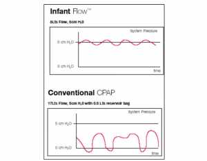 Hình. (10). So sánh giữa tác động của CPAP theo phương pháp thông thường và bởi phương pháp Infant Flow (Electro Medical Equipment Ltd., UK). Đồ thị biểu diễn cung cấp bởi nhà sản xuất.