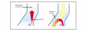 Hình. (9). Coanda Effect. Trong thời gian hít vào, bộ phận tạo áp lực biến đổi năng lượng động học của dòng khí thành áp lực, tạo điều kiện không khí vào phổi và giảm công thở. Trong quá trình thở ra, việc chuyển hướng dòng khí tạo điều kiện cho việc thở ra.