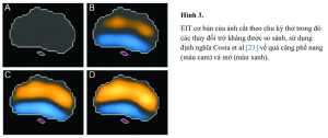 Hình 3. EIT cơ bản của ảnh cắt theo chu kỳ thở trong đó các thay đổi trở kháng được so sánh, sử dụng định nghĩa Costa et al [23] về quá căng phế nang (màu cam) và mở (màu xanh).