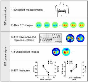Hình 1: Sơ đồ trình bày kiểm tra EIT lồng ngực và phân tích dữ liệu. Các bản vẽ, ví dụ về hình ảnh EIT và các biện pháp EIT minh họa các bước khác nhau có liên quan. Các hình ảnh được tạo ra bằng thuật toán tái tạo hình ảnh GREIT từ dữ liệu thu được trong một chủ đề người lớn khỏe mạnh với thiết bị GoE-MF II EIT (CareFusion, Höchberg, Đức). (Những hình ảnh này cũng như dữ liệu được trình bày trong các số liệu tiếp theo bắt nguồn từ các kiểm tra được ủy ban đạo đức thể chế phê duyệt và có được sự đồng ý bằng văn bản.) ARDS, hội chứng suy hô hấp cấp tính; EIT, chụp cắt lớp trở kháng điện; rel. ΔZ, sự thay đổi trở kháng tương đối; GI, chỉ số không đồng nhất tổng thể; CoV, trung tâm thông khí; PEEP, áp lực dương cuối thì thở ra; ROP, áp lực mở khu vực; RVD, độ trễ thông khí khu vực.
