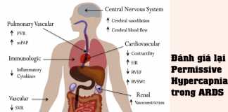 Đánh giá lại Permissive Hypercapnia trong ARDS