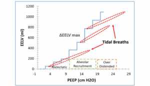 Ba vùng huy động phổi được xác định bằng ΔEELV/ΔPEEP. Ba máy cung cấp thể tích khí lưu thông 300 mL được sử dụng. Áp lực cần thiết đẩ cung cấp mỗi nhịp thở được tính toán từ giá trị CRS xuất phát từ các đồ thị CRS so với PEEP (Hình 2). Nhịp thở bắt đầu ở PEEP là 15 (PEEP tối ưu được xác định từ ΔEELV/ΔPEEP tối đa) sẽ chấm dứt trong một vùng quá căng chướng phế nang. Nhịp thở bắt đầu ở PEEP thấp hơn ΔEELV/ΔPEEP tối đa sẽ bao gồm một loạt các tuyển dụng thông thường và tránh được xẹp phổi.