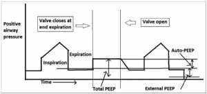 Expiratory hold manoeuvre to estimate auto-positive end-expiratory pressure