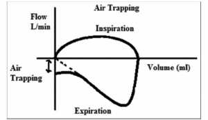 Air trapping in flow-volume loop