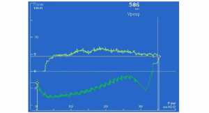 Hình 2: Biểu đồ Paw/Flow plot