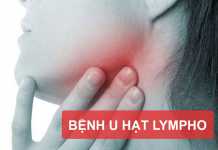 Bệnh U hạt Lympho