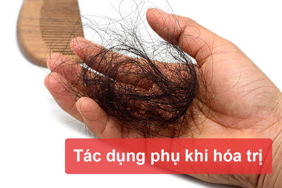 Tác dụng phụ gặp phải khi điều trị U hạt Lympho