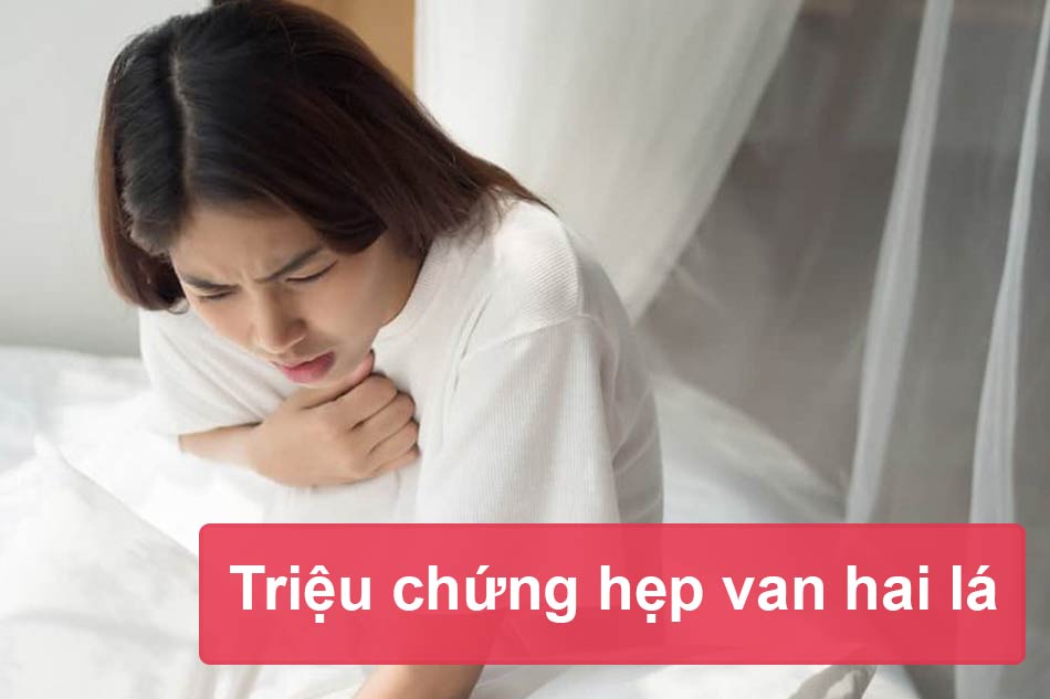 Triệu chứng lâm sàng của hẹp van hai lá