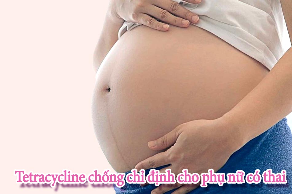 Chống chỉ định cho phụ nữ có thai