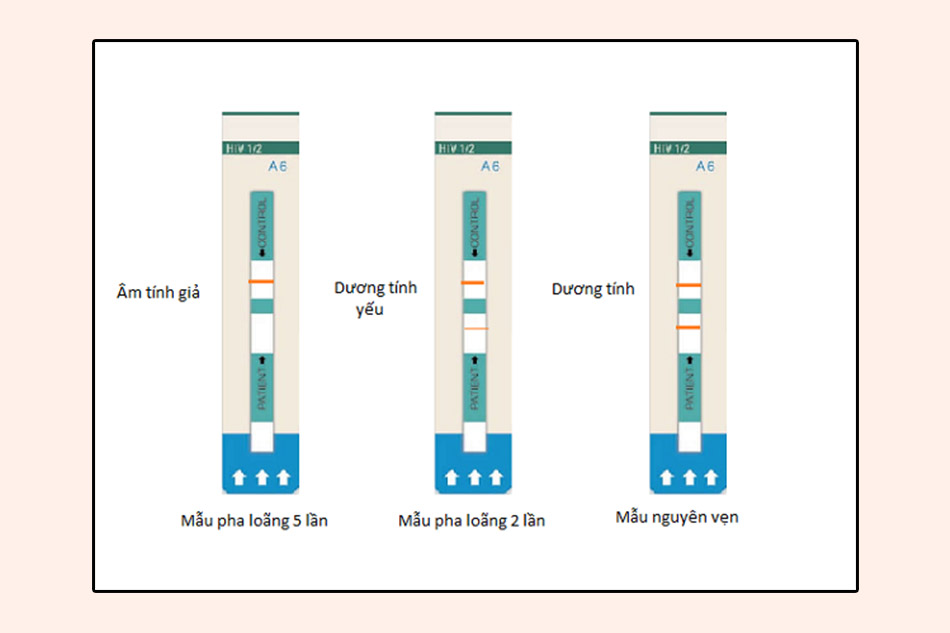 Các kết quả khi test nhanh HIV