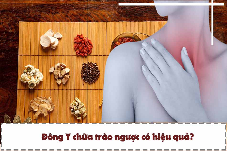 Chữa trào ngược bằng Đông y có thực sự hiệu quả?