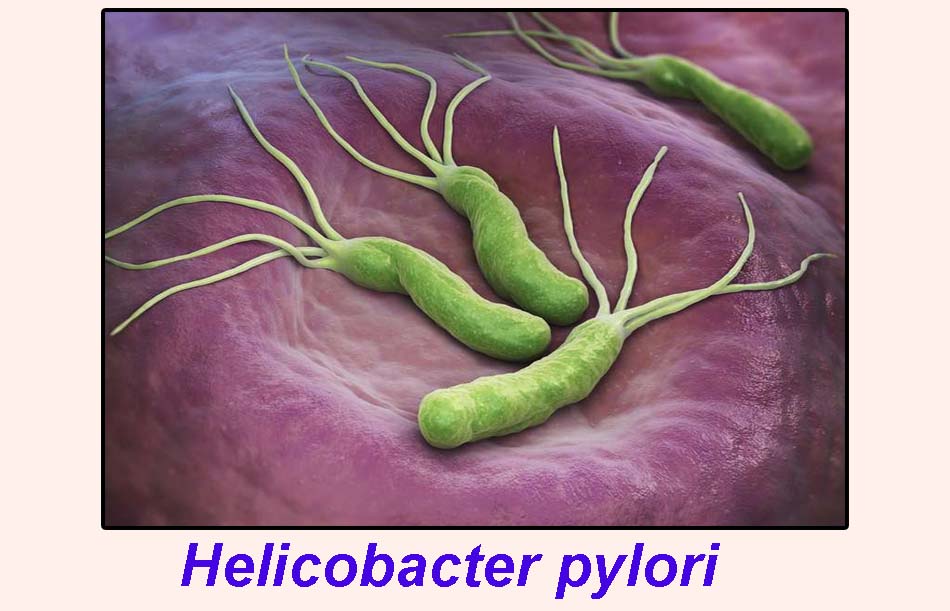 Vi khuẩn Helicobacter pylori