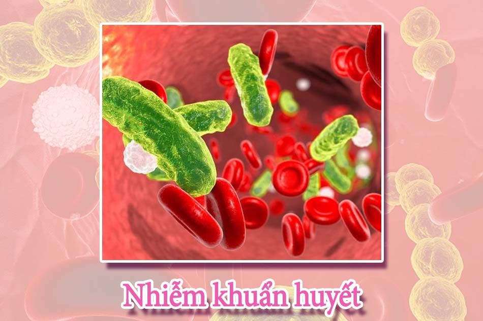 Kháng sinh Lipopeptide dùng điều trị nhiễm khuẩn huyết