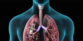 Hội chứng đông đặc phổi