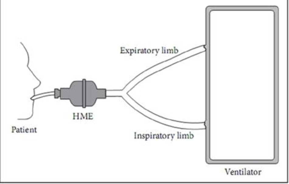 Hình 4: Vị trí HME trong mạch thông khí.