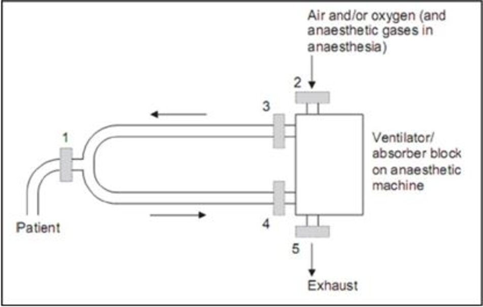 Hình 1 Các vị trí có thể có của bộ lọc hệ thống dây máy thở. 1: tại cổng kết nối với bệnh nhân; 2: trên cổng đầu vào của không khí; 3: trên cổng nhánh hít vào; 4: trên cổng nhánh thở ra; 5: trên cổng xả.