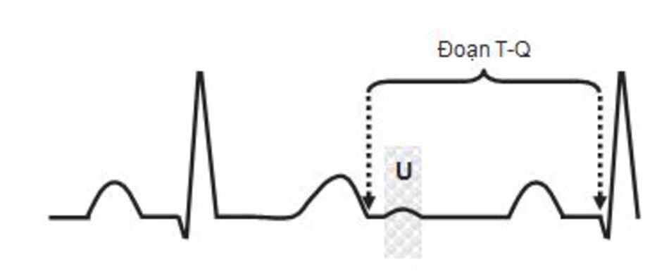Hình 2.10: Sóng U và đoạn T-Q. Sóng U là sóng cuối cùng trong ECG và được ghi lại tốt nhất ở chuyển đạo V2 và V3 vì những chuyển đạo này nằm gần cơ thất nhất. Nguyên nhân của sóng U rất có thể là do sự tái cực của hệ His-Purkinje. Sóng U bất thường khi nó đảo ngược hoặc trở nên quá nổi bật, như trong bối cảnh hạ kali máu. Đoạn T-Q tương ứng với pha 4 của điện thế hoạt động. Nó đánh dấu sự kết thúc của điện thế hoạt động trước đó và bắt đầu điện thế tiếp theo.