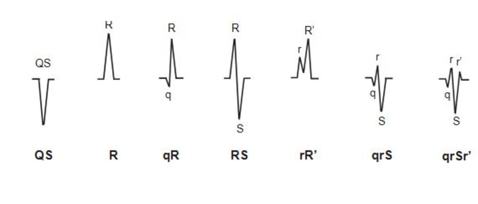 Hình 2.5: Danh pháp QRS. Sơ đồ biểu diễn cách xác định các sóng trong phức bộ QRS.