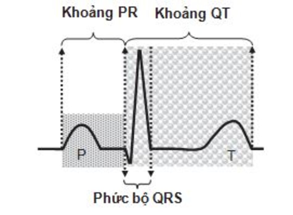 Hình 2.7: Khoảng PR, phức bộ QRS và QT. Khoảng PR được tính từ đầu sóng P đến đầu phức bộ QRS. Phức bộ QRS được tính từ đầu sóng đầu tiên đến cuối sóng cuối cùng và khoảng QT được tính từ đầu phức bộ QRS đến cuối sóng T. 