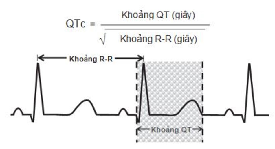 Hình 2.8: Khoảng QT. Khoảng QT được tính từ điểm bắt đầu phức bộ QRS đến điểm kết thúc sóng T. Khi tần số tim 70 lần/ phút, ta có thể dùng mắt để ước chừng QTc là bình thường nếu QT nhỏ hơn hoặc bằng 1/2 khoảng R-R. Khi có điều này không cần phải tính toán. Nếu QT lớn hơn 1/2 khoảng R-R, QTc có thể không bình thường và nên được tính toán (xem ví dụ hình. 2.9).