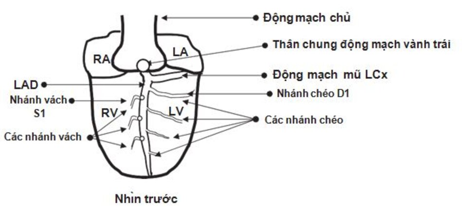 Hình 23.14: Sơ đồ minh họa động mạch LAD và các nhánh của nó. Từ thân chung của động mạch vành trái chia ra 2 nhánh lớn: động mạch liên thất trước (LAD) và động mạch vành mũ (LCx). LAD đi trong rãnh liên thất trước. Nó cho các nhánh chéo đến thành trước và thành bên của thất trái, cho các nhánh vách đi trực tiếp vuông góc vào vách liên thất. LA: nhı ̃ trái; LAD: động mạch liên thất trước; LCx: động mạch vành mũ; LV: thất trái; RA: nhı ̃ phải; RV: thất phải.
