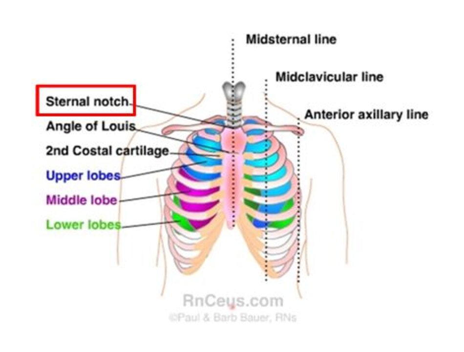 xương ức (sternal notch)