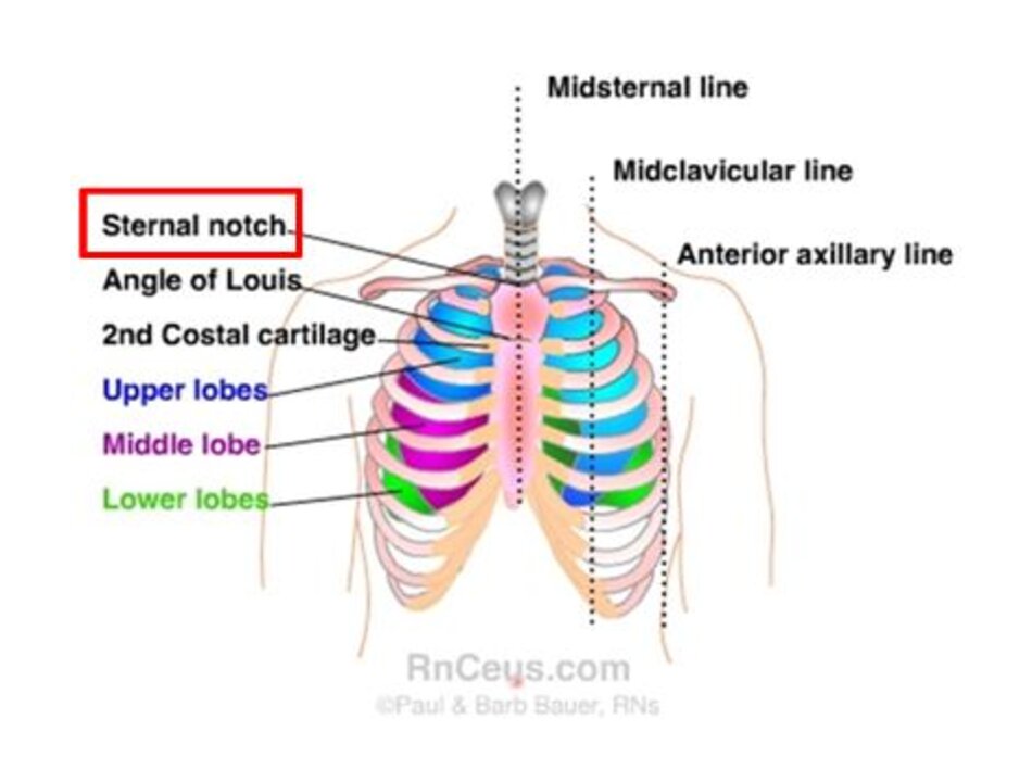 xương ức (sternal notch) 