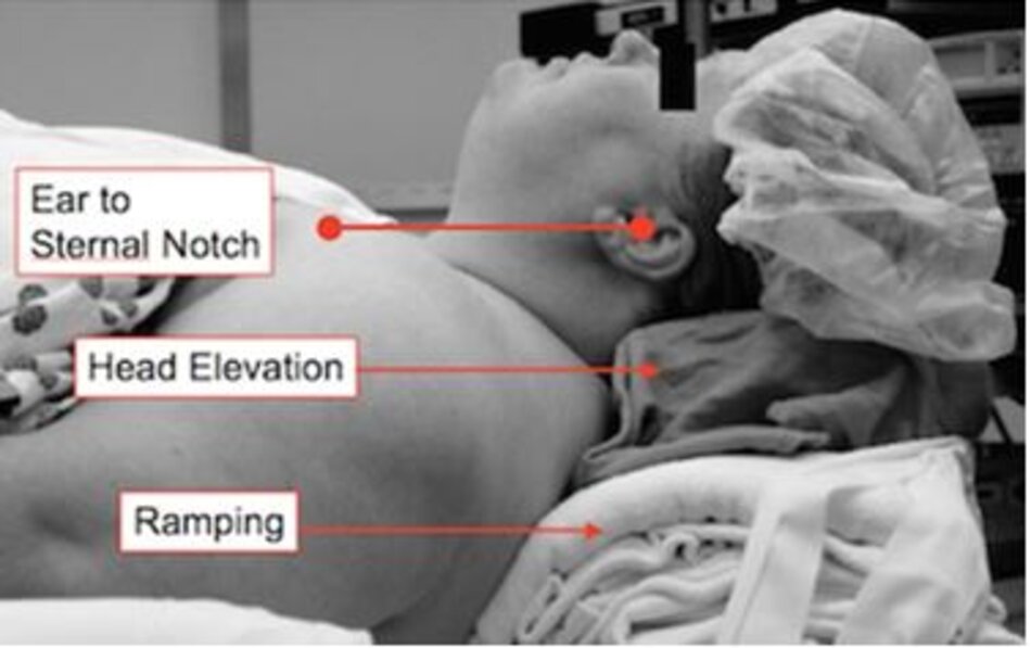 Pic from FOAMEM