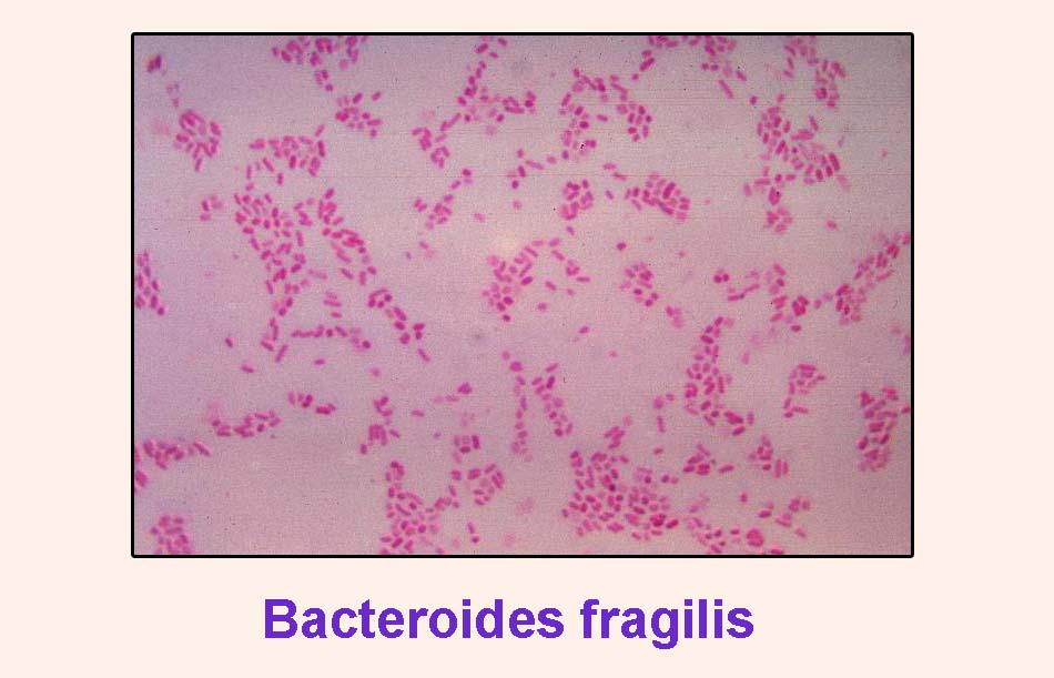 Vi khuẩn Bacteroides fragilis