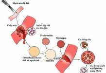 Sử dụng lâm sàng các xét nghiệm đông máu (uptodate)