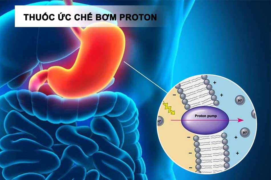 Thuốc ức chế bơm proton