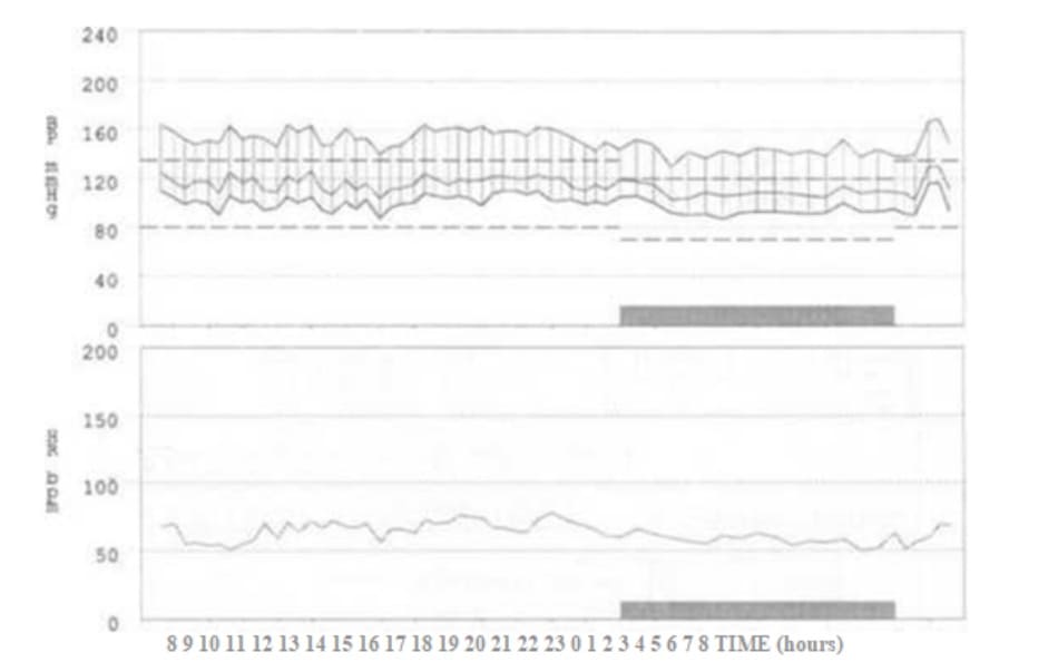 FIGURE 1.1 24-Hour ambulatory blood pressure monitoring