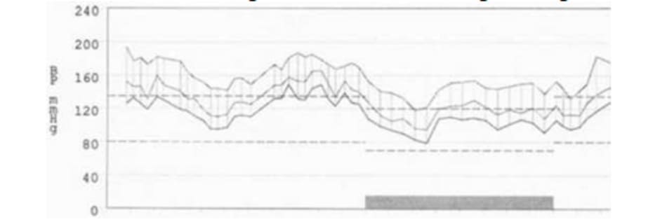 FIGURE 2.1 24-hour blood pressure profile