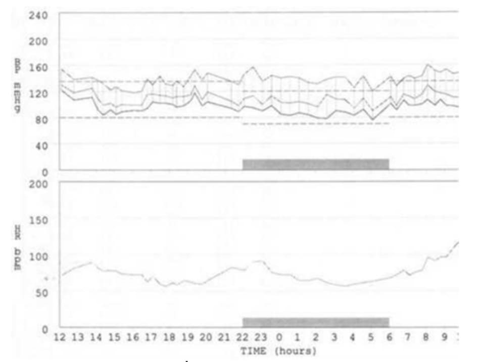 FIGURE 4.6 24-hour blood pressure profile at second follow-up visit