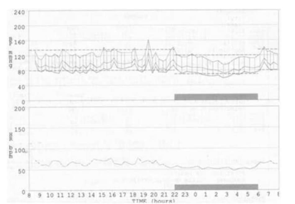 FIGURE 5.3 24-hour blood pressure profile 