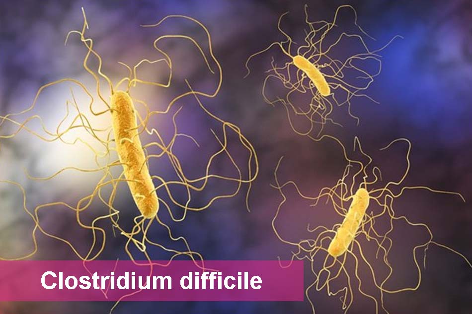 Vi khuẩn Clostridium difficile