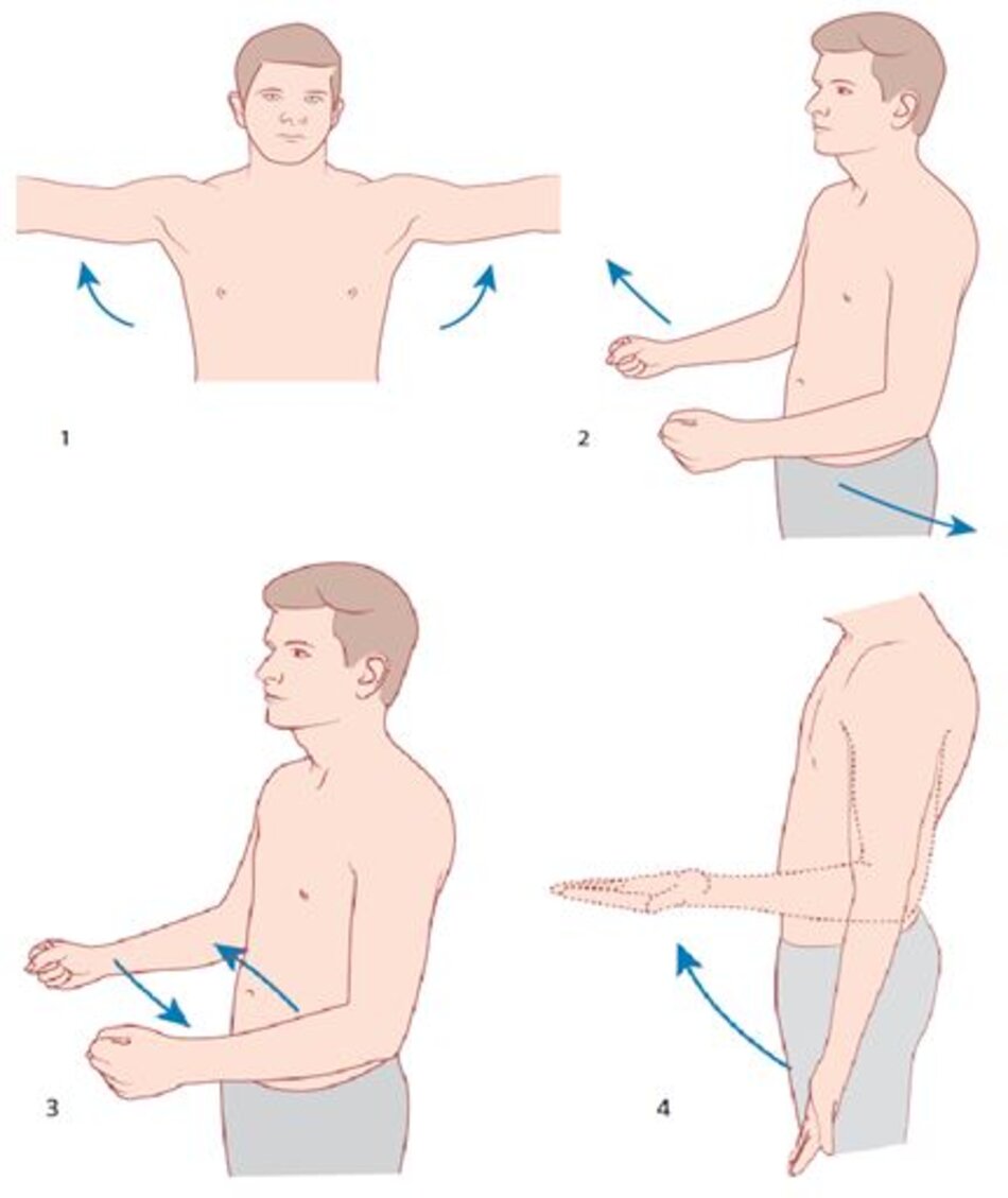 Hình 5.1 Ý nghĩa cơn đau: 1, Dạng cưỡng ép; 2, Xoay ngoài cưỡng ép; 3, Xoay trong cưỡng ép; 4, Ngửa và gấp cẳng tay cưỡng ép.