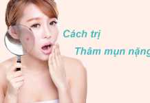 Cách trị thâm mụn nặng