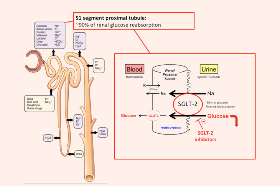 Cơ chế tác dụng của các thuốc ức chế SGLT2