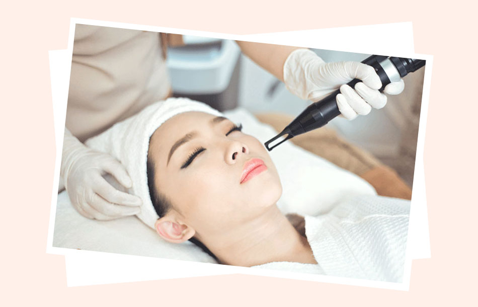 Điều trị vết thâm mụn cứng đầu bằng tia Laser