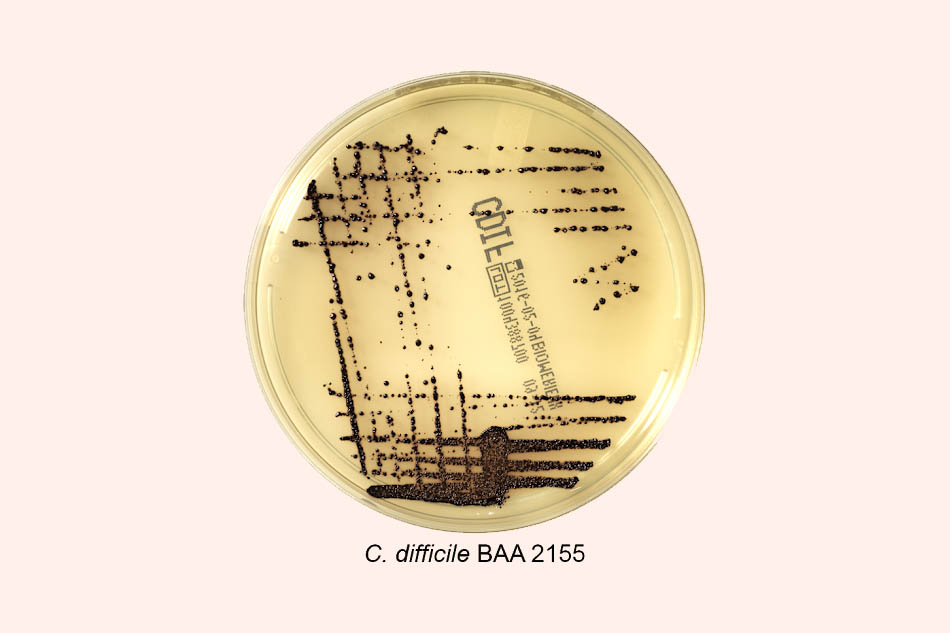 Vi khuẩn Clostridium difficile