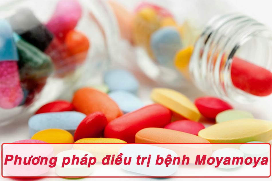 Phương pháp điều trị bệnh Moyamoya