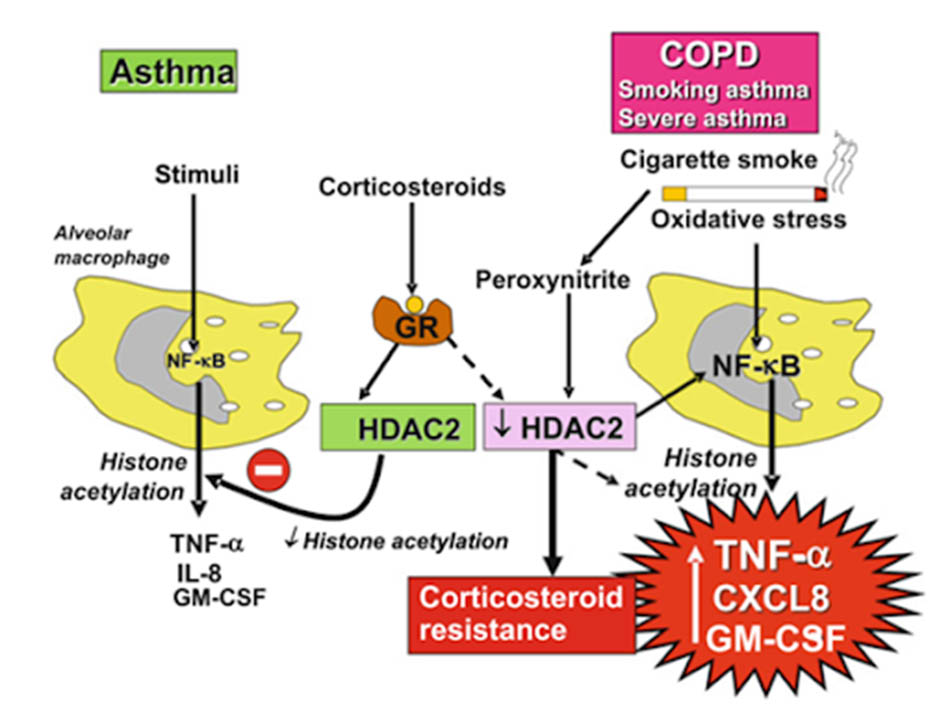 Ảnh. Cơ chế đề kháng glucocorticoid trong COPD thông qua stress oxy hóa và giảm hoạt tính HDAC2.