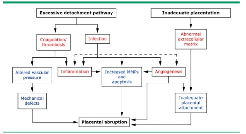 Mô hình khái niệm cho thấy đông máu / huyết khối, nhiễm trùng, viêm, tân sinh mạch và các con đường chuyển hóa collagen dẫn đến bong nhau thai