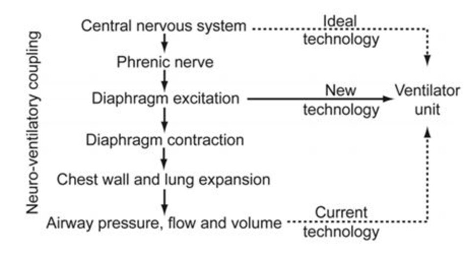 Hình 1. Trình tự kiểm soát thông khí thần kinh, từ tín hiệu hít vào thần kinh đến khi hít vào (cơ học). Cảm biến để kích hoạt hít vào càng được đặt gần bộ điều khiển trung tâm, thì công nghệ này càng được tích hợp tốt hơn với khớp nối thần kinh - thông khí. Hỗ trợ thông khí được điều chỉnh bằng thần kinh (NAVA) đáp ứng với kích thích cơ hoành. (Từ Tham chiếu 6, với sự cho phép)