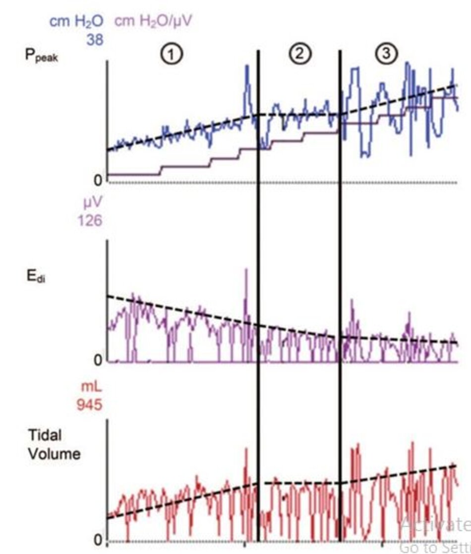 Hình 4. Các dạng sóng áp lực đỉnh (Ppeak), hoạt động điện của cơ hoành (EAdi) và thể tích khí lưu thông từ một bệnh nhân đang sử dụng phương pháp hỗ trợ thông khí được điều chỉnh bằng thần kinh (NAVA), với mức NAVA tăng dần. Trong biểu đồ trên cùng, đường cong bậc thang cho thấy mức NAVA tăng dần theo từng bước. Với mức NAVA tăng lên, Ppeak và thể tích khí lưu thông tăng lên trong khi EAdi giảm. Trong cột 1, bệnh nhân không được hỗ trợ đầy đủ: với khớp nối thần kinh - thông khí còn nguyên vẹn, bệnh nhân tăng nỗ lực hô hấp bằng cách tăng tín hiệu EAdi nhằm tăng thể tích khí lưu thông. Trong cột 2, tín hiệu EAdi tiếp tục giảm từ từ trong khi Ppeak và thể tích khí lưu thông không đổi: đây là cái gọi là “vùng thoải mái” nơi bệnh nhân được thả lỏng đầy đủ. Nếu thể tích khí lưu thông đáp ứng được nhu cầu của bệnh nhân, bệnh nhân sẽ giảm nỗ lực khi mức NAVA tăng lên.27 Trong cột 3, tín hiệu EAdi tiếp tục giảm trong khi Ppeak và thể tích khí lưu thông tăng: trong phần này của đường cong, sự hỗ trợ của máy thở được coi là không cao.