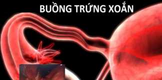 Xoắn buồng trứng và ống dẫn trứng trong phụ khoa